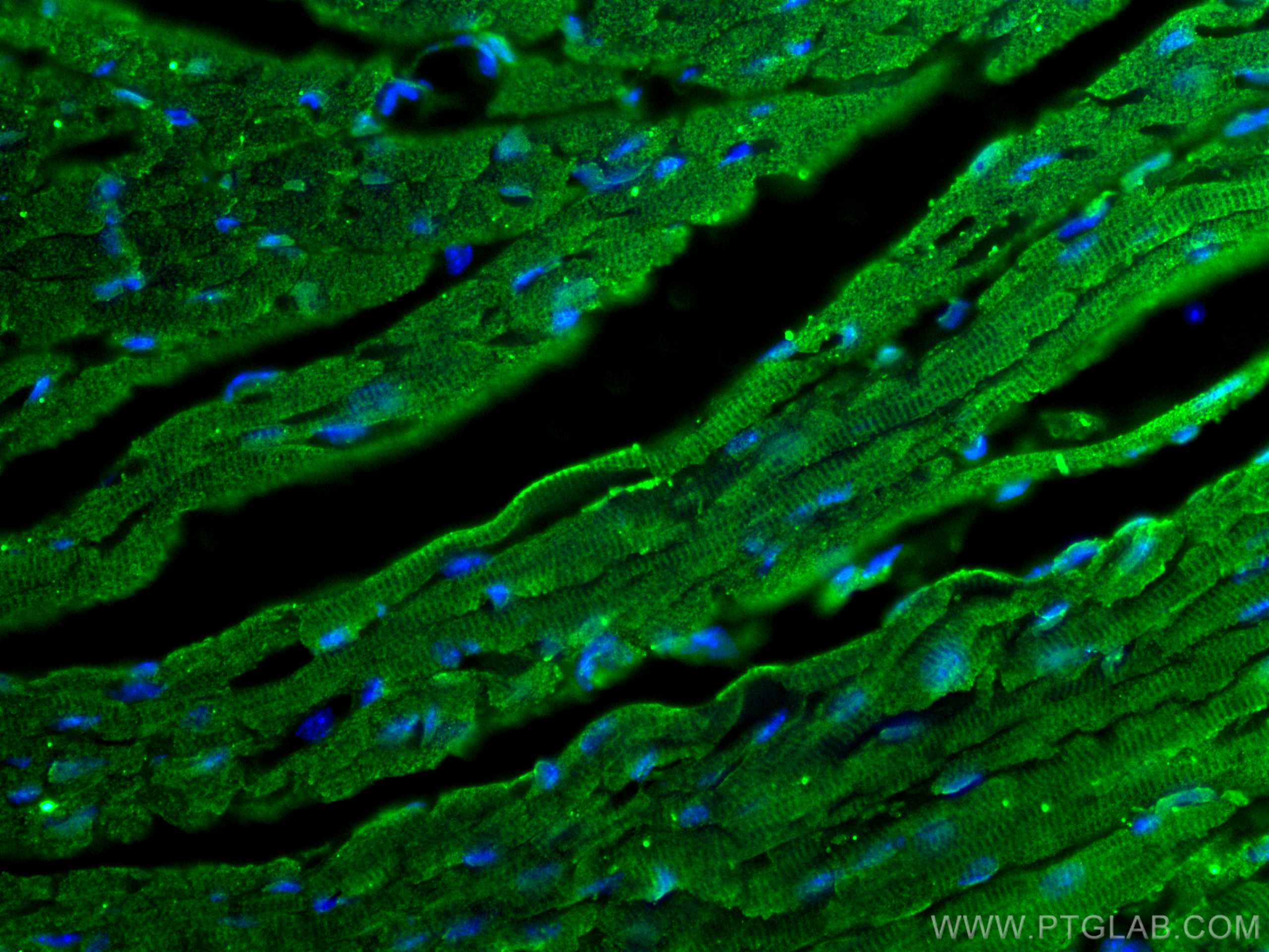 Immunofluorescence (IF) / fluorescent staining of mouse heart tissue using SOCS3 Monoclonal antibody (66797-1-Ig)