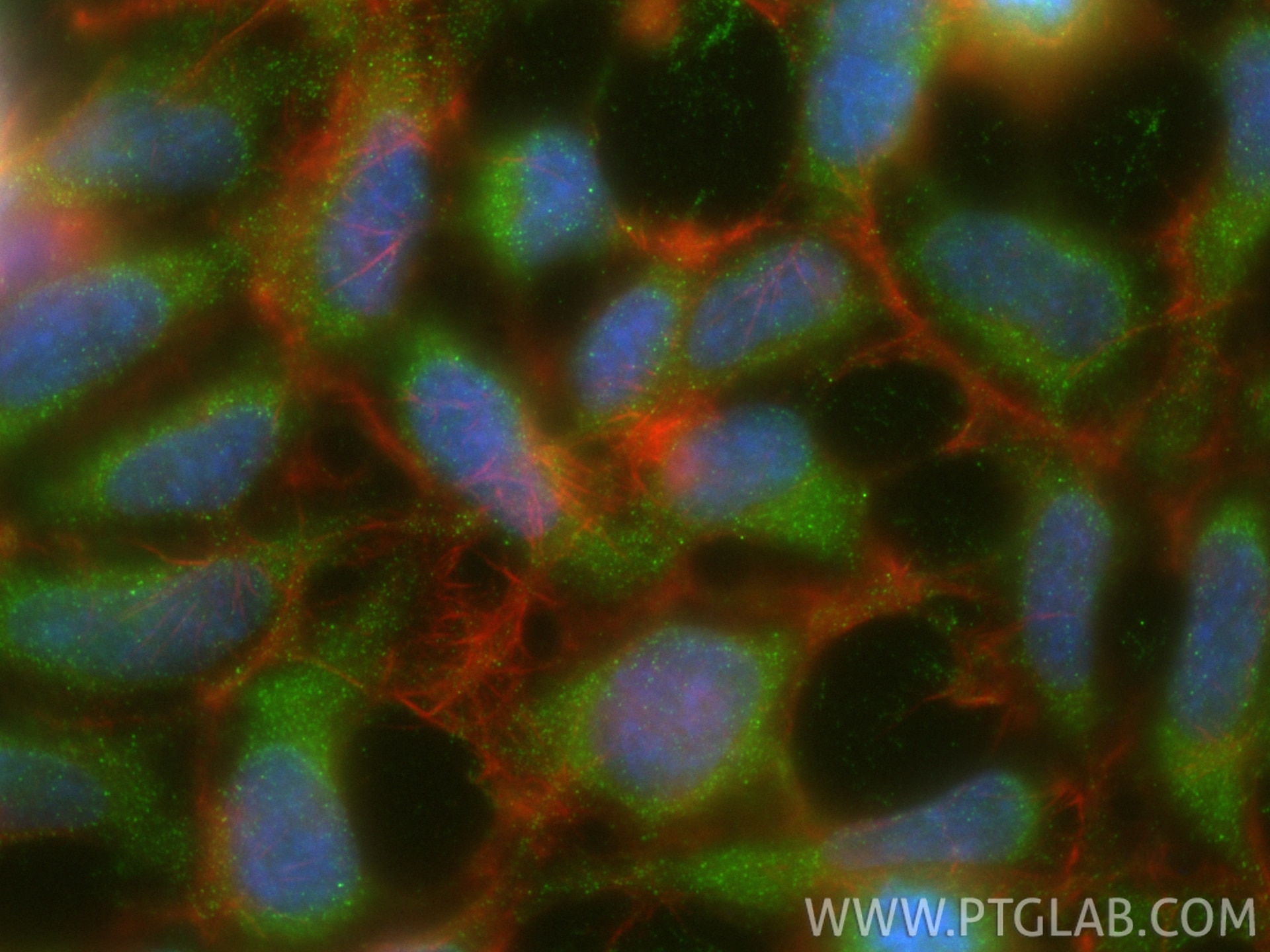 IF Staining of HEK-293 using 66797-1-Ig Immunofluorescence (IF) / fluorescent staining of HEK-293 cells using SOCS3 Monoclonal antibody (66797-1-Ig)