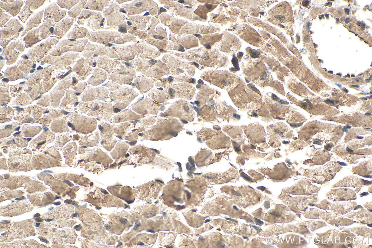 Immunohistochemistry (IHC) staining of mouse heart tissue using SOCS3 Monoclonal antibody (66797-1-Ig)