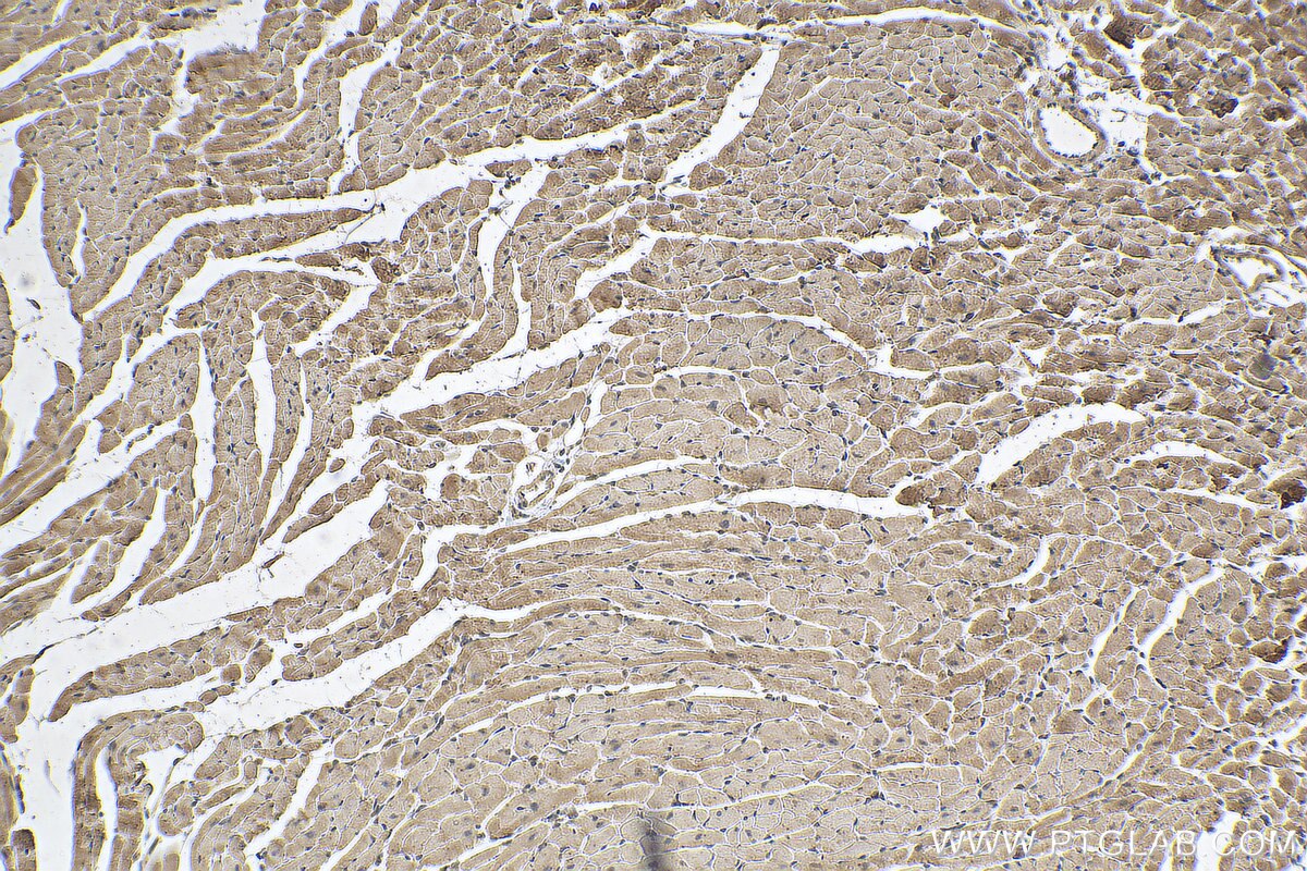 Immunohistochemistry (IHC) staining of mouse heart tissue using SOCS3 Monoclonal antibody (66797-1-Ig)