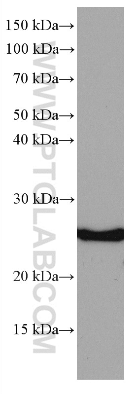 Western Blot (WB) analysis of Jurkat cells using SOCS3 Monoclonal antibody (66797-1-Ig)