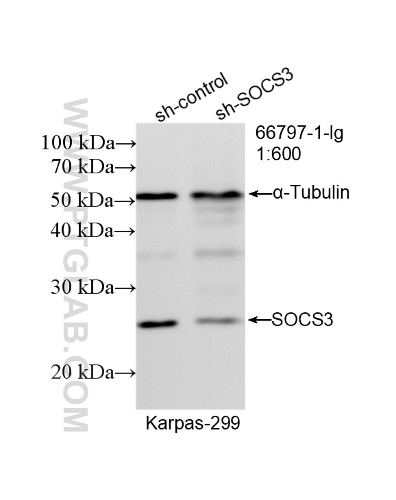 Western Blot (WB) analysis of Karpas-299 cells using SOCS3 Monoclonal antibody (66797-1-Ig)