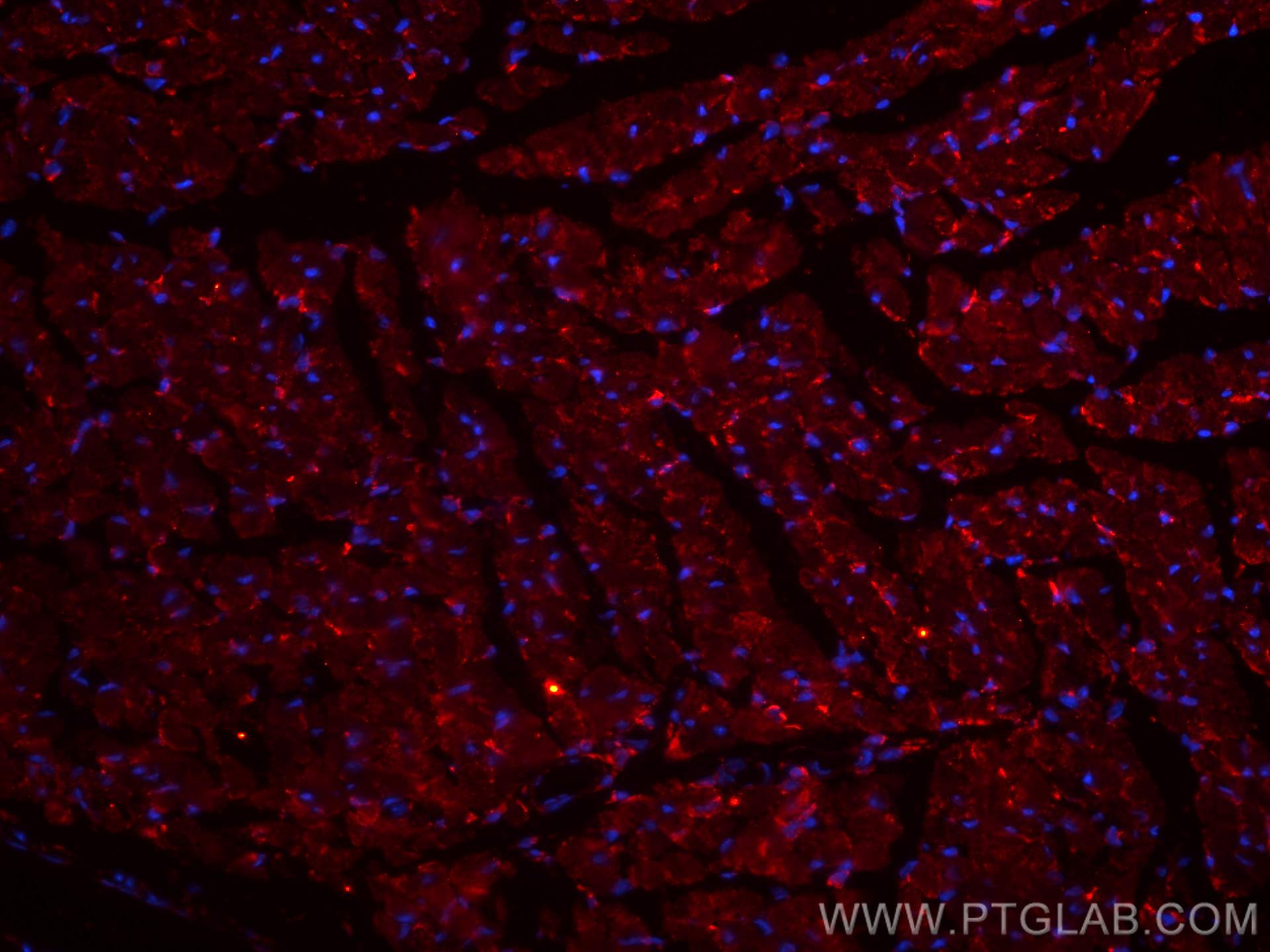 IF Staining of mouse heart using CL594-66797