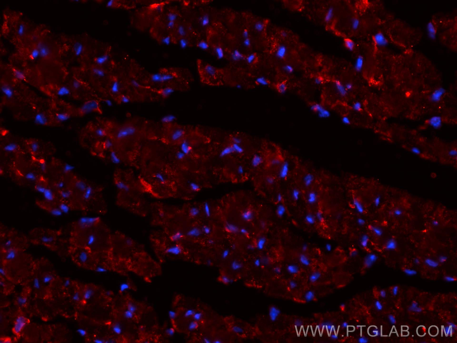Immunofluorescence (IF) / fluorescent staining of mouse heart tissue using CoraLite®594-conjugated SOCS3 Monoclonal antibody (CL594-66797)