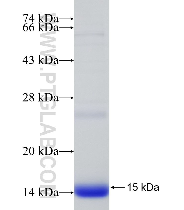 SOCS3 fusion protein Ag31548 SDS-PAGE SOCS3 fusion protein Ag31548 SDS-PAGE