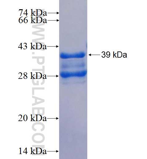 SOCS4 fusion protein Ag25887 SDS-PAGE
