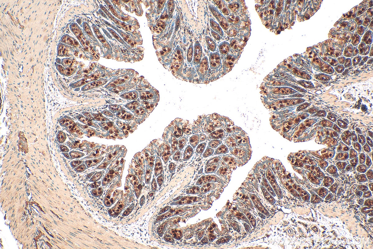 Immunohistochemistry (IHC) staining of mouse colon tissue using SOCS6 Polyclonal antibody (27343-1-AP)