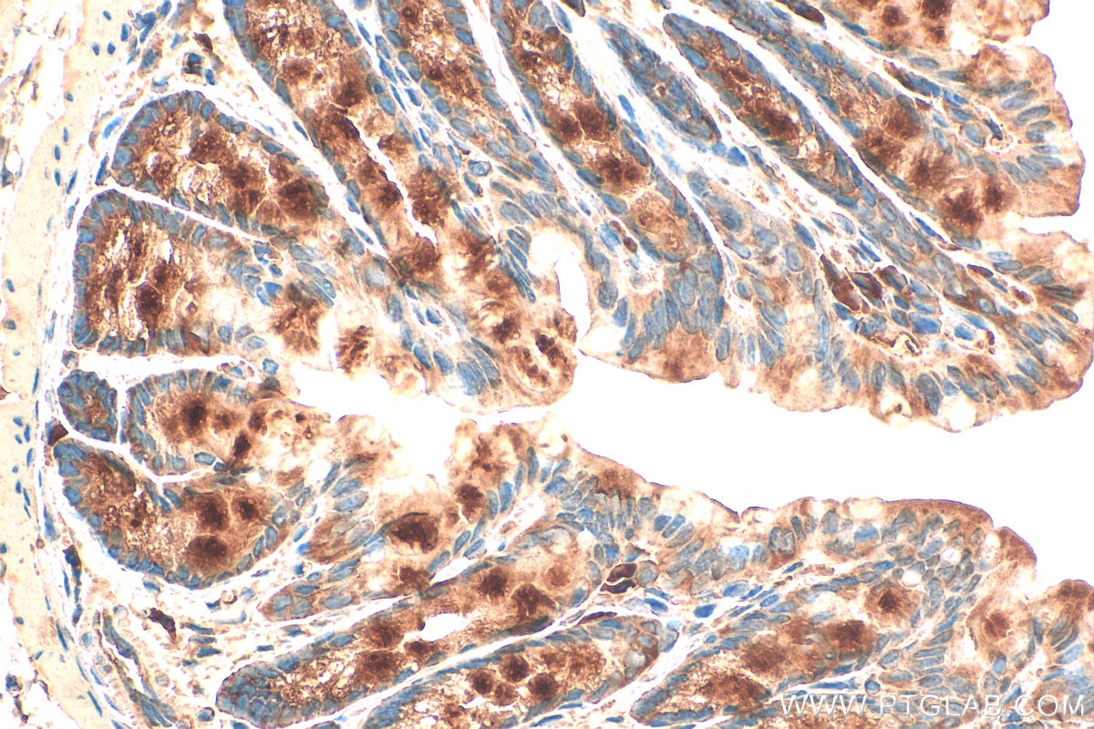 Immunohistochemistry (IHC) staining of mouse colon tissue using SOCS6 Polyclonal antibody (27343-1-AP)