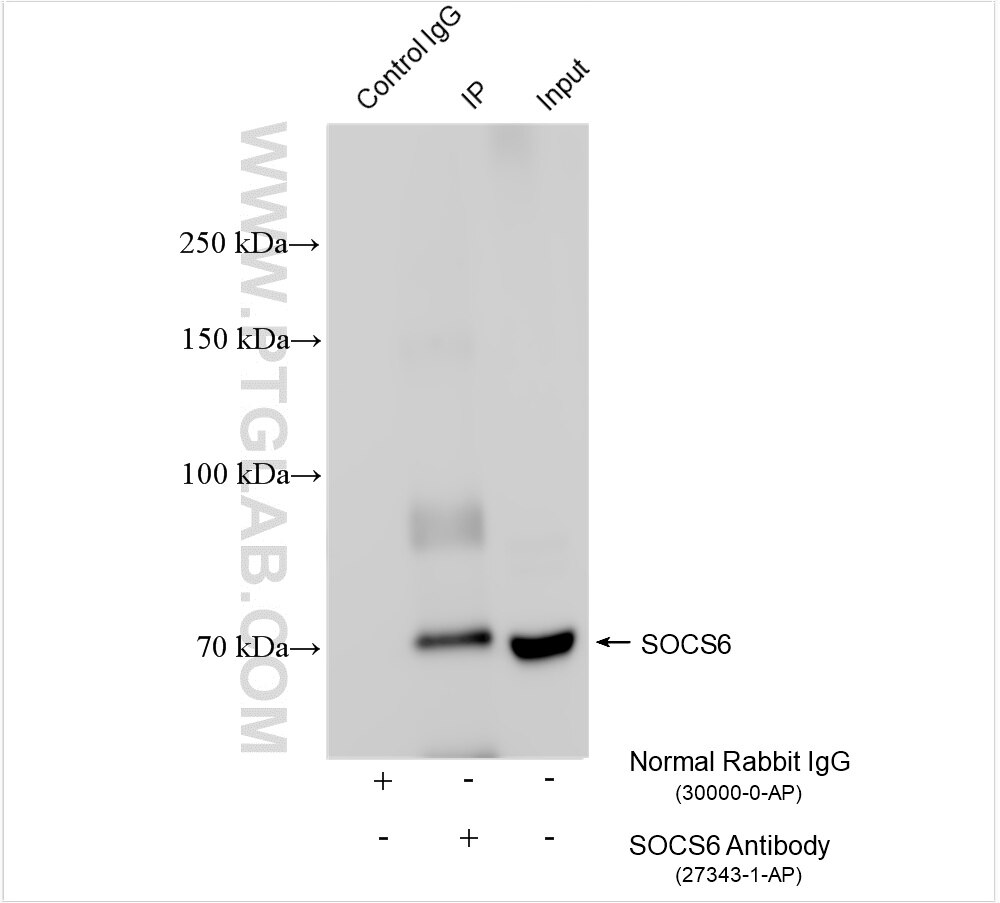 Immunoprecipitation (IP) experiment of human placenta tissue using SOCS6 Polyclonal antibody (27343-1-AP)