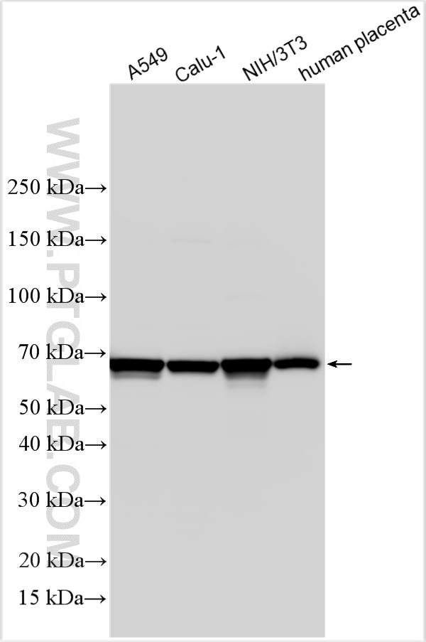 Western Blot (WB) analysis of various lysates using SOCS6 Polyclonal antibody (27343-1-AP)