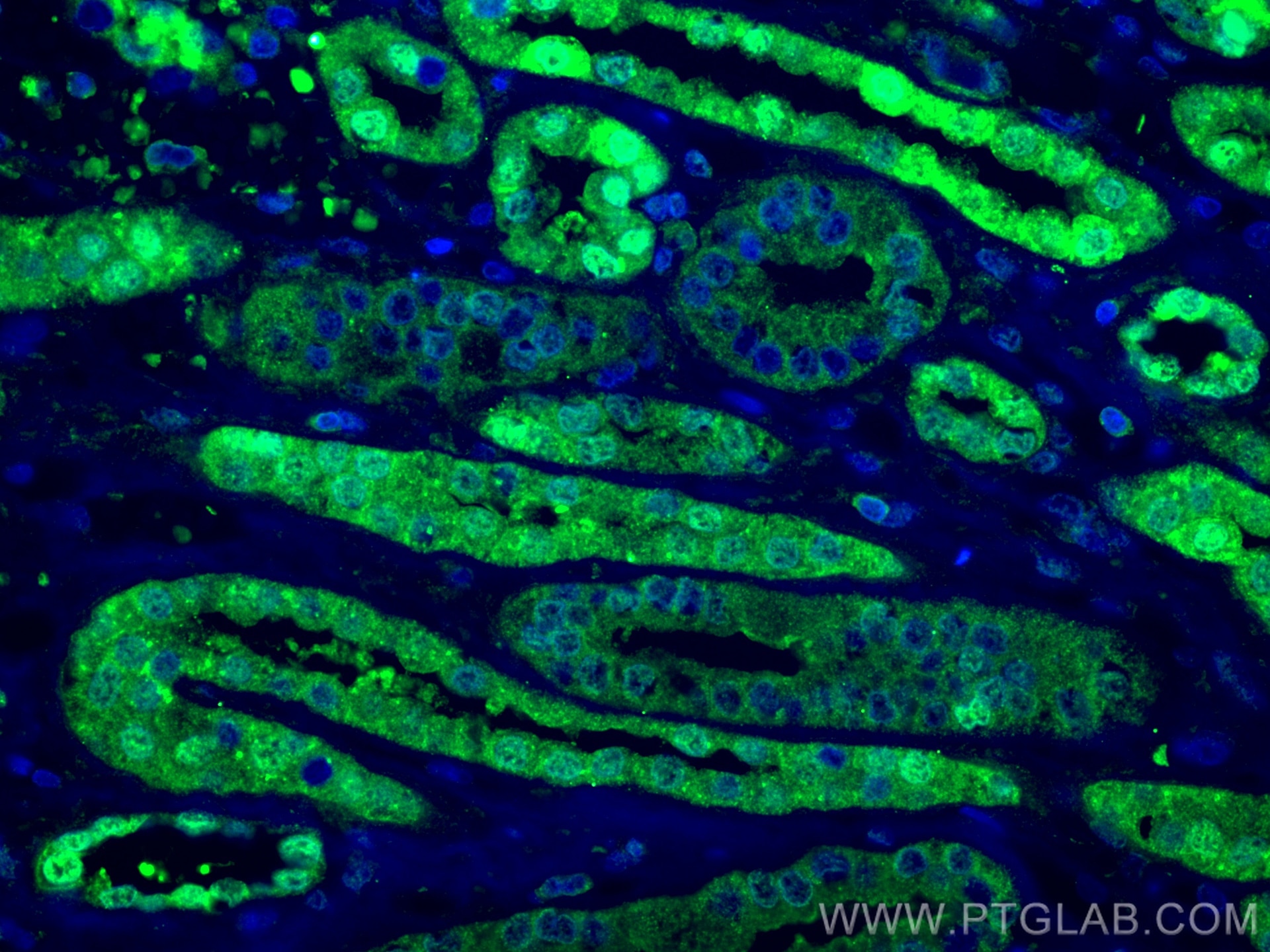 Immunofluorescence (IF) / fluorescent staining of human kidney tissue using SOD1 Polyclonal antibody (10269-1-AP)