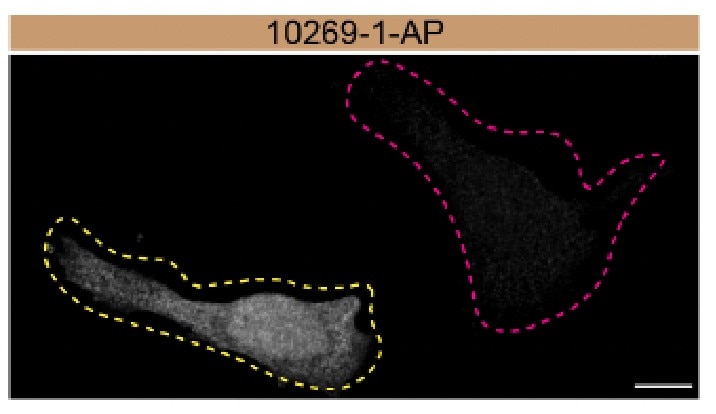 IF Staining of HeLa using 10269-1-AP