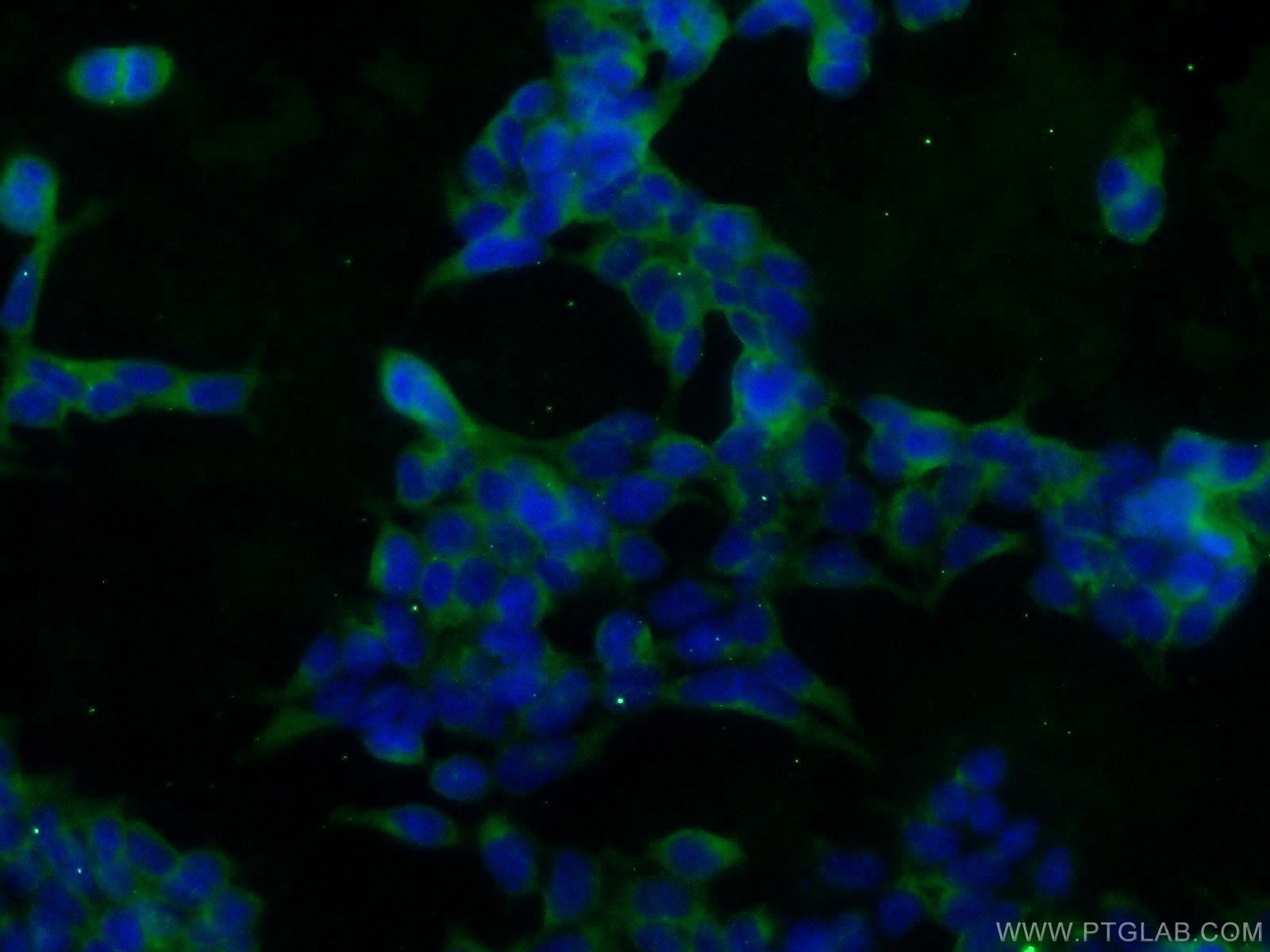 Immunofluorescence (IF) / fluorescent staining of HEK-293 cells using SOD1 Polyclonal antibody (10269-1-AP)