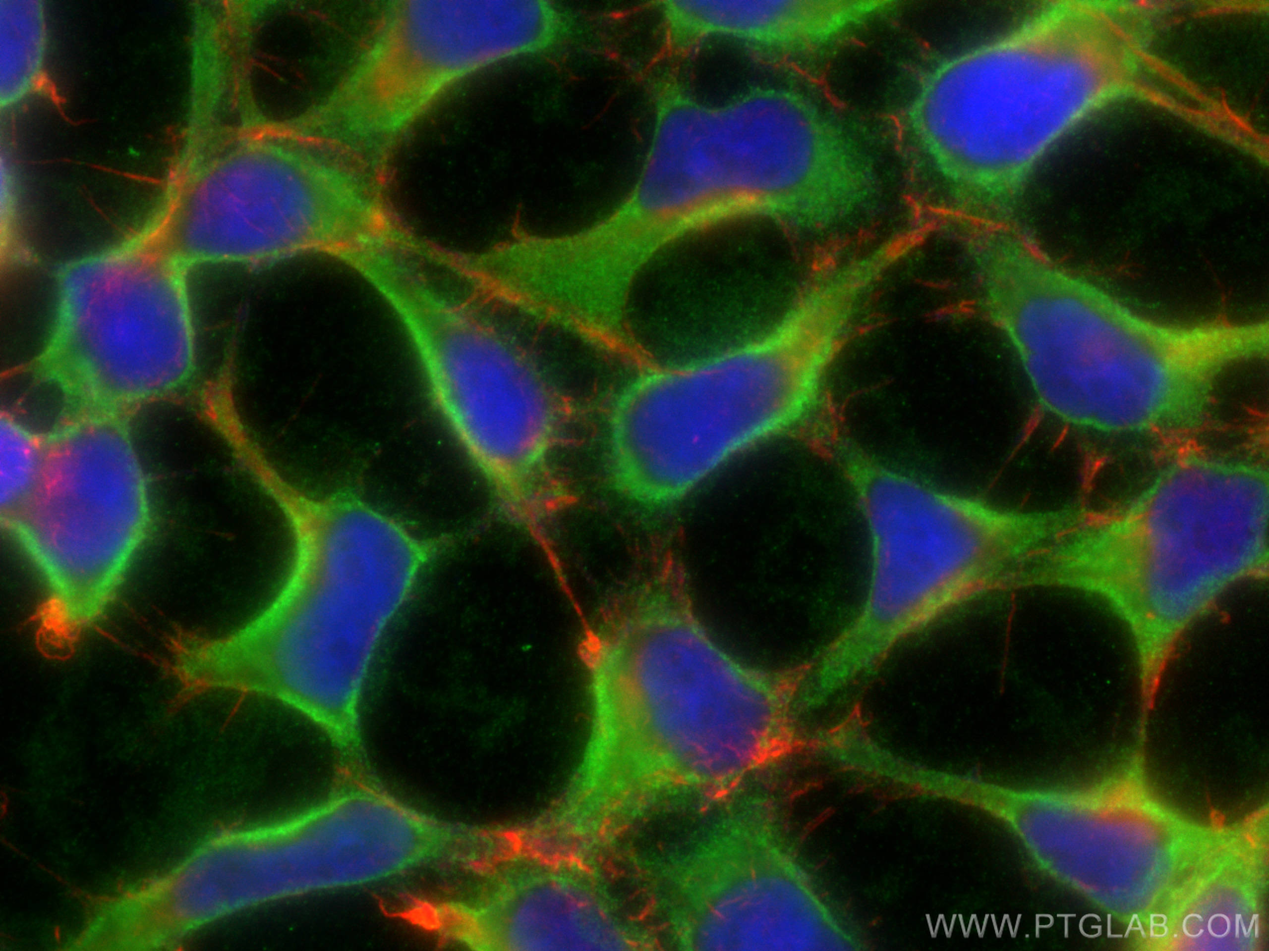 Immunofluorescence (IF) / fluorescent staining of HEK-293 cells using SOD1 Polyclonal antibody (10269-1-AP)