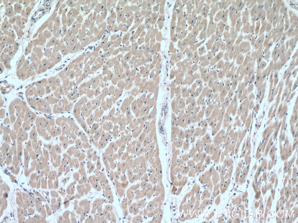 Immunohistochemistry (IHC) staining of human heart tissue using SOD1 Polyclonal antibody (10269-1-AP)