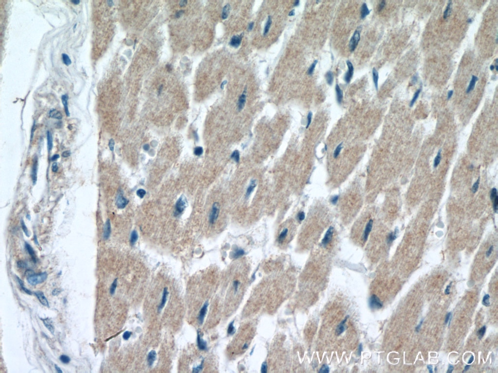 Immunohistochemistry (IHC) staining of human heart tissue using SOD1 Polyclonal antibody (10269-1-AP)