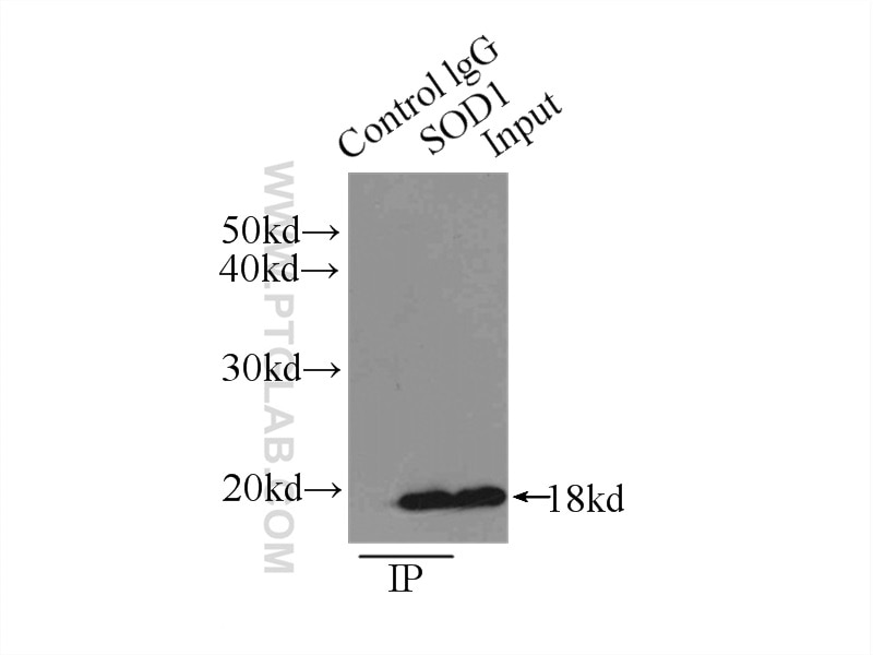 Immunoprecipitation (IP) experiment of HEK-293 cells using SOD1 Polyclonal antibody (10269-1-AP)