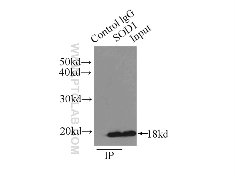 IP experiment of HEK-293 using 10269-1-AP