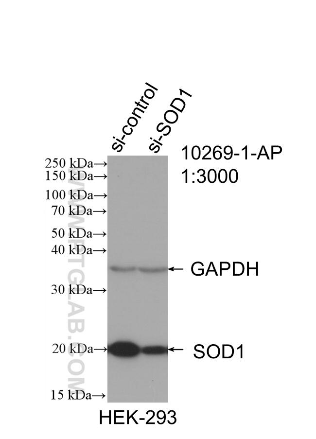 Western Blot (WB) analysis of HEK-293 cells using SOD1 Polyclonal antibody (10269-1-AP)
