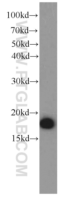 SOD1 Polyclonal antibody