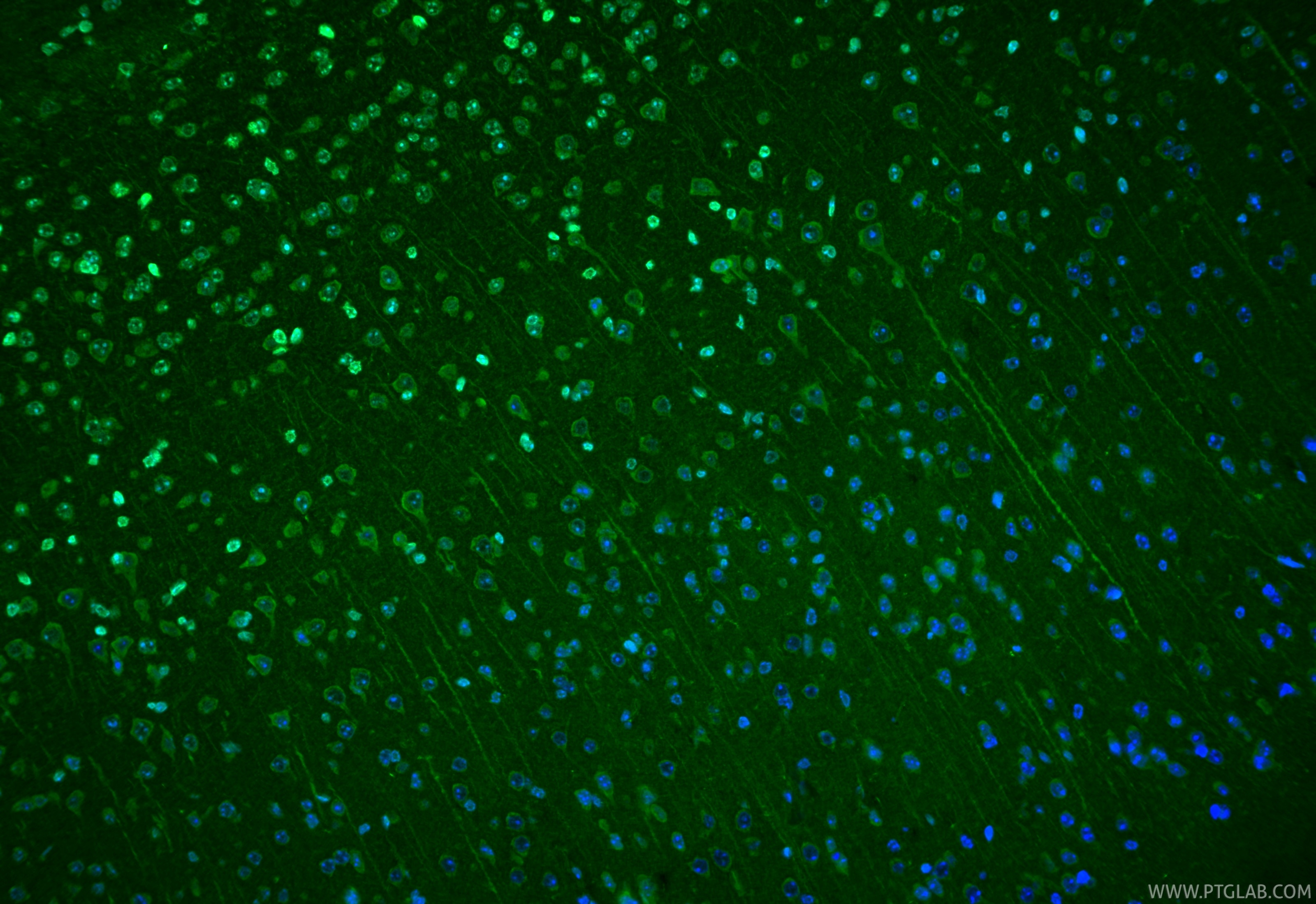Immunofluorescence (IF) / fluorescent staining of mouse brain tissue using SOD1 Polyclonal antibody (31400-1-AP)