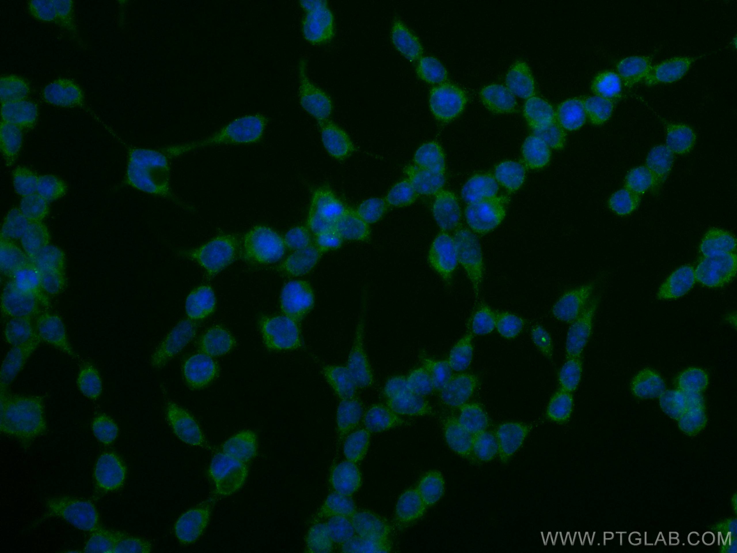 Immunofluorescence (IF) / fluorescent staining of HEK-293T cells using SOD1 Monoclonal antibody (67480-1-Ig)