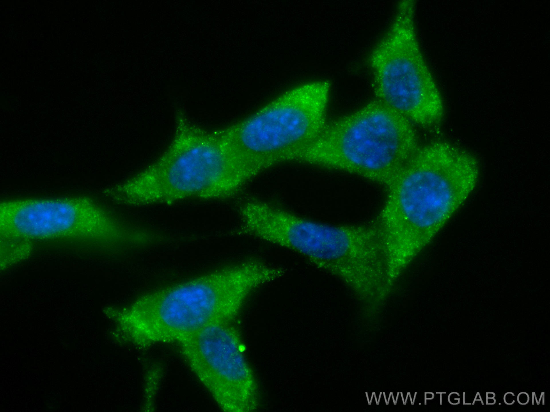 Immunofluorescence (IF) / fluorescent staining of NIH/3T3 cells using SOD1 Monoclonal antibody (67480-1-Ig)
