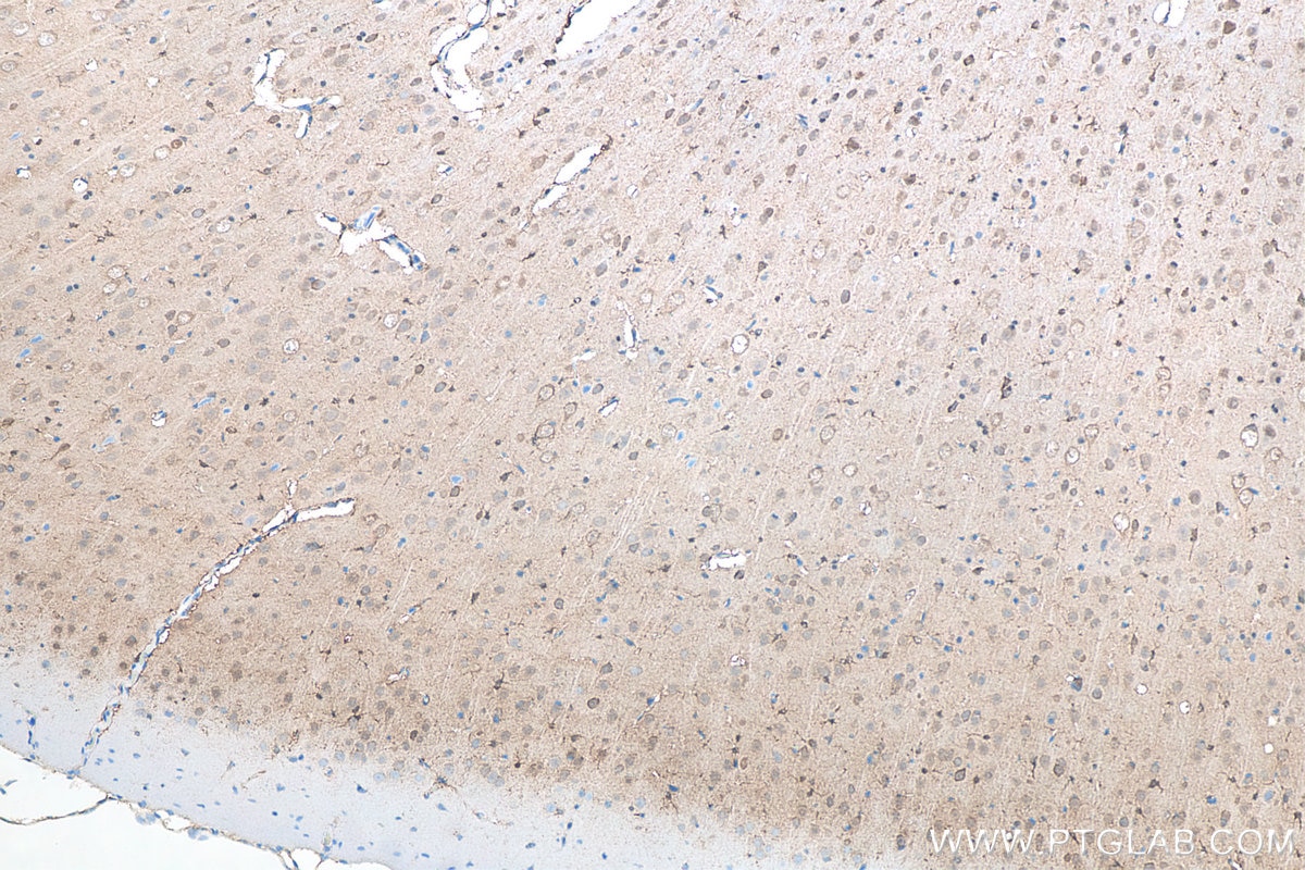 IHC staining of rat brain using 67480-1-Ig