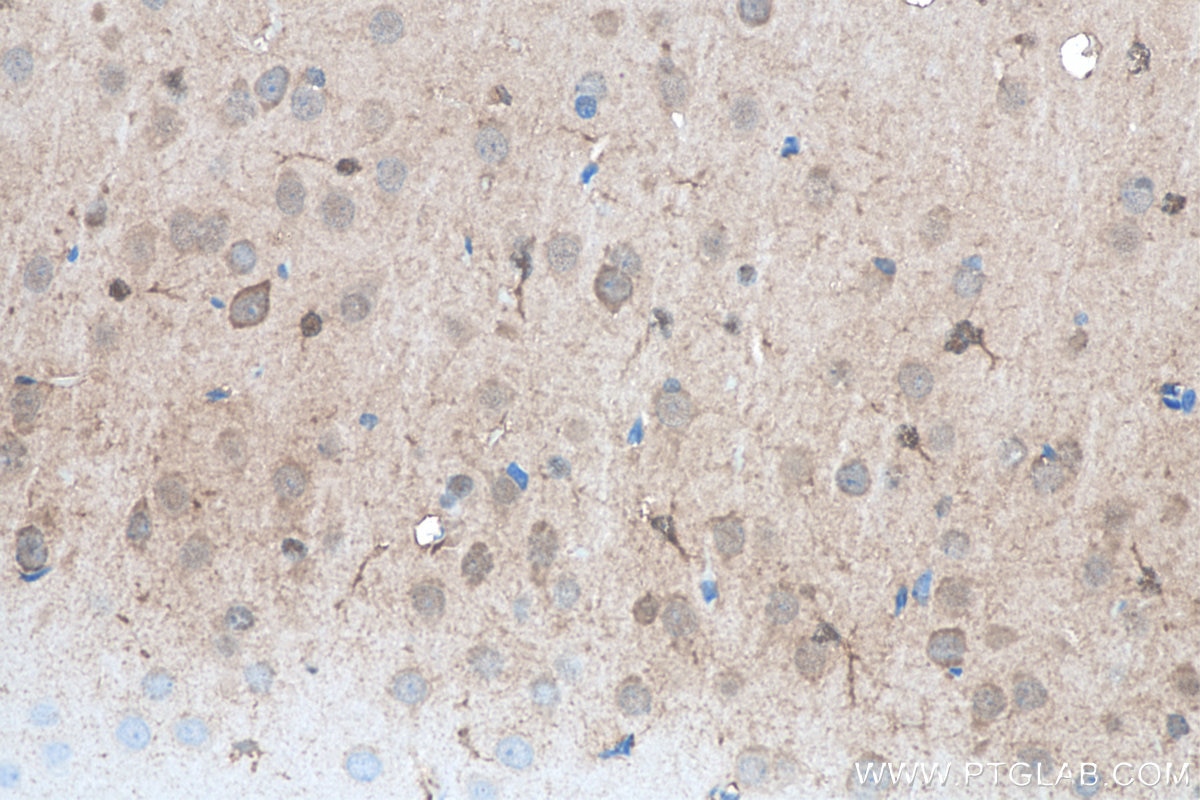 Immunohistochemistry (IHC) staining of rat brain tissue using SOD1 Monoclonal antibody (67480-1-Ig)