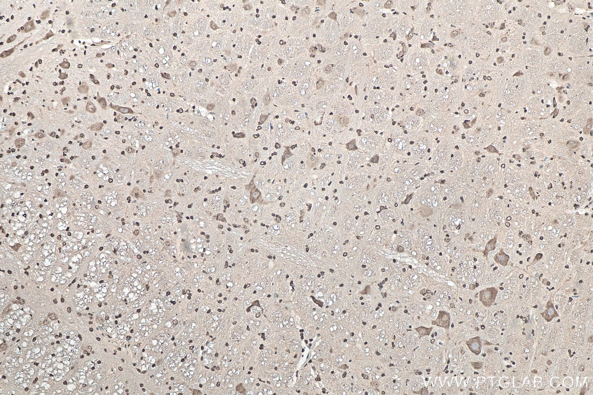 IHC staining of rat cerebellum using 67480-1-Ig Immunohistochemistry (IHC) staining of rat cerebellum tissue using SOD1 Monoclonal antibody (67480-1-Ig)