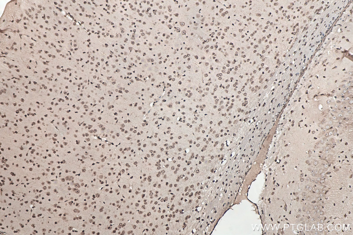 Immunohistochemistry (IHC) staining of mouse brain tissue using SOD1 Monoclonal antibody (67480-1-Ig)