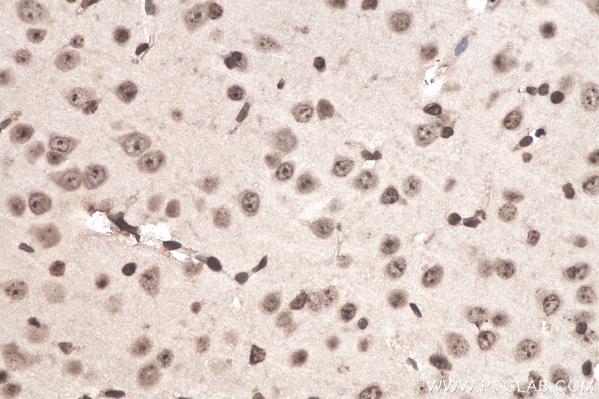 Immunohistochemistry (IHC) staining of mouse brain tissue using SOD1 Monoclonal antibody (67480-1-Ig)