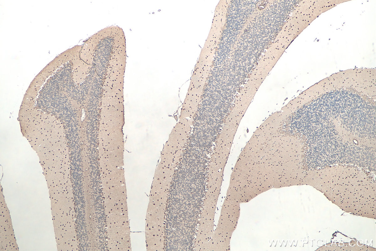 IHC staining of mouse cerebellum using 67480-1-Ig Immunohistochemistry (IHC) staining of mouse cerebellum tissue using SOD1 Monoclonal antibody (67480-1-Ig)