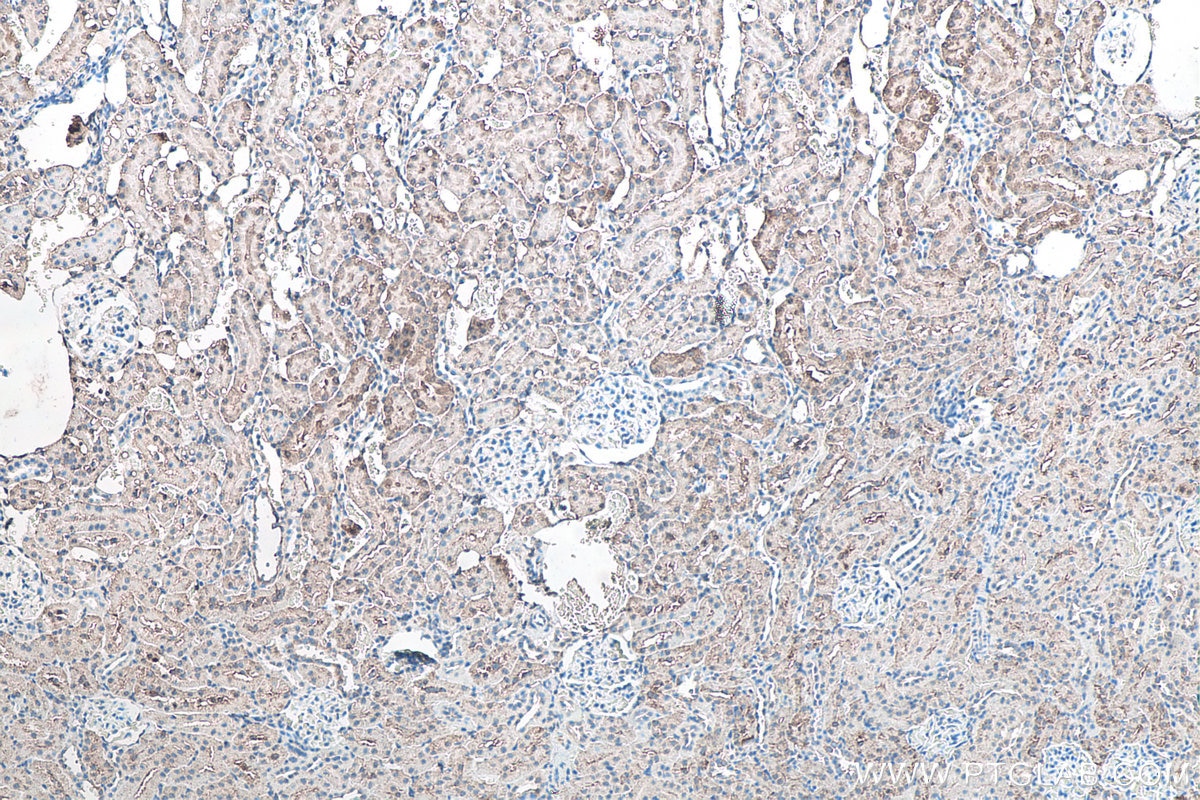 IHC staining of rat kidney using 67480-1-Ig Immunohistochemistry (IHC) staining of rat kidney tissue using SOD1 Monoclonal antibody (67480-1-Ig)