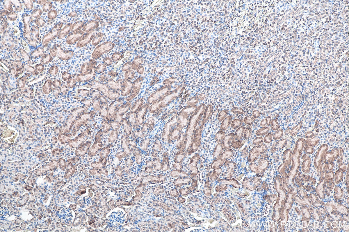 IHC staining of mouse kidney using 67480-1-Ig Immunohistochemistry (IHC) staining of mouse kidney tissue using SOD1 Monoclonal antibody (67480-1-Ig)
