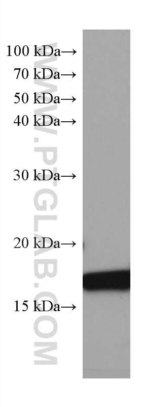 Western Blot (WB) analysis of pig brain tissue using SOD1 Monoclonal antibody (67480-1-Ig)