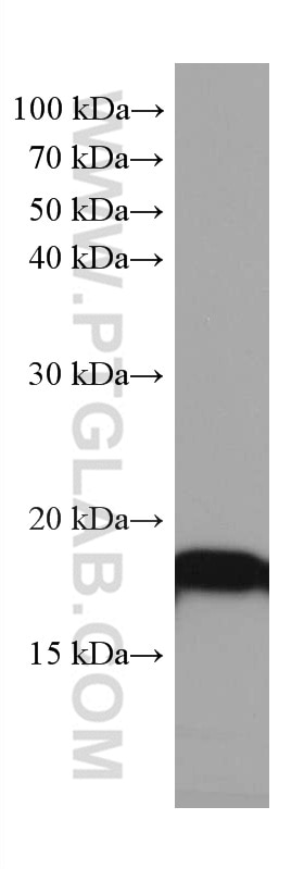 Western Blot (WB) analysis of rat brain tissue using SOD1 Monoclonal antibody (67480-1-Ig)