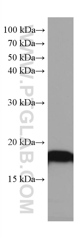 WB analysis of rat brain using 67480-1-Ig