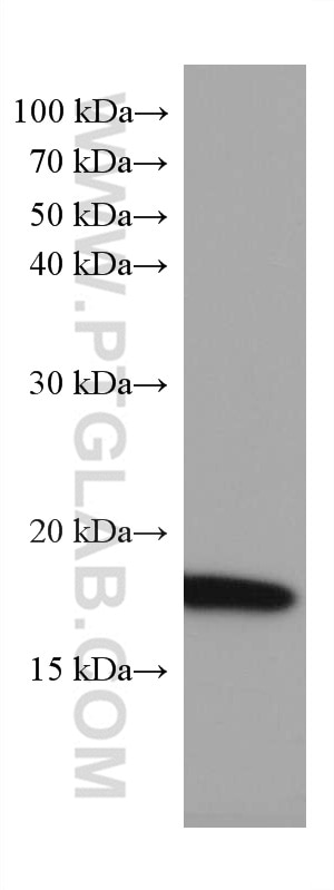 WB analysis of mouse brain using 67480-1-Ig