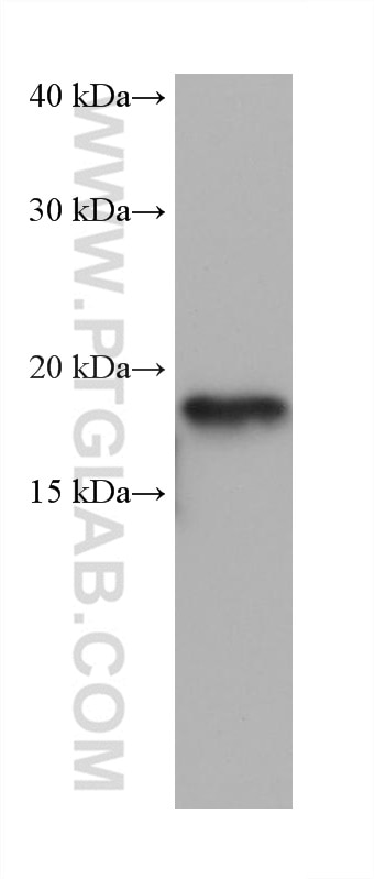 Western Blot (WB) analysis of rabbit brain tissue using SOD1 Monoclonal antibody (67480-1-Ig)