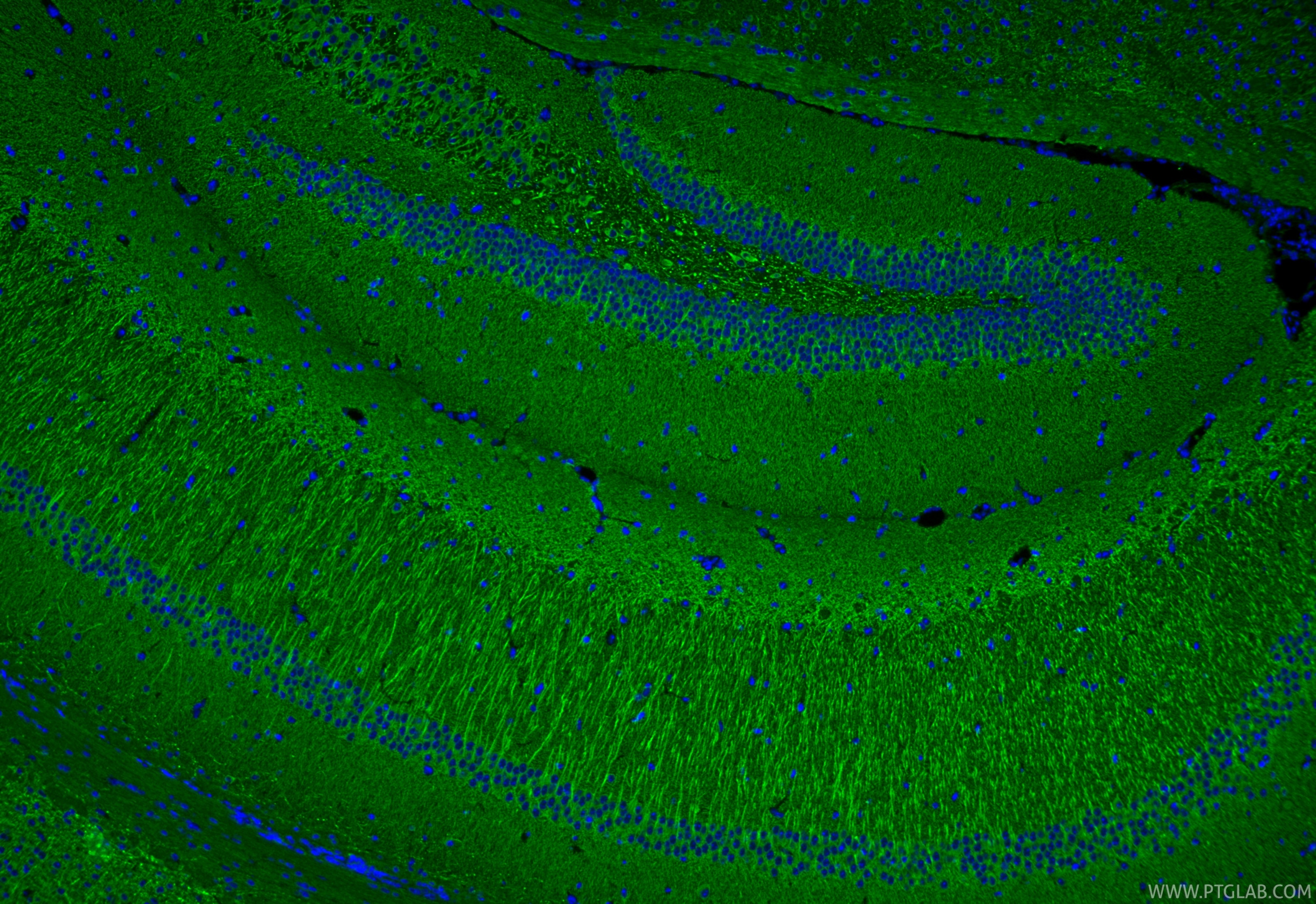 Immunofluorescence (IF) / fluorescent staining of mouse brain tissue using SOD1 Recombinant monoclonal antibody (83857-6-RR)