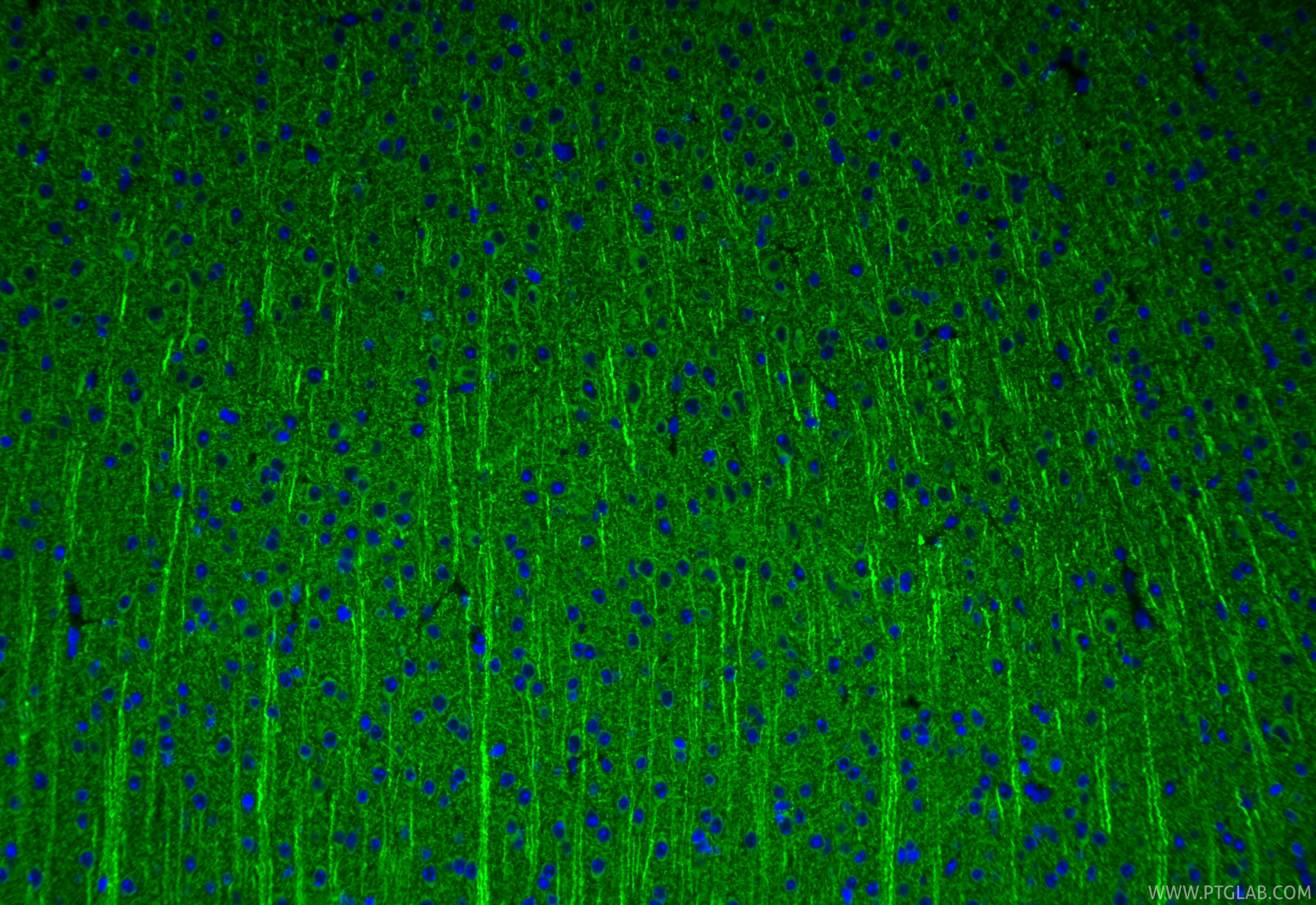 Immunofluorescence (IF) / fluorescent staining of mouse brain tissue using SOD1 Recombinant monoclonal antibody (83857-6-RR)