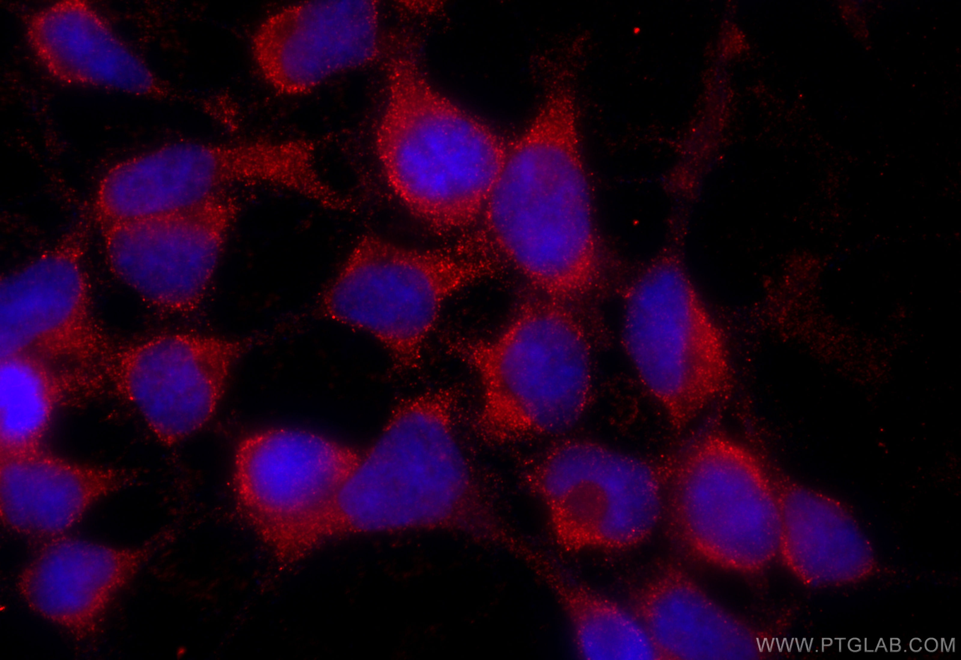 Immunofluorescence (IF) / fluorescent staining of HEK-293 cells using CoraLite®594-conjugated SOD1 Monoclonal antibody (CL594-67480)