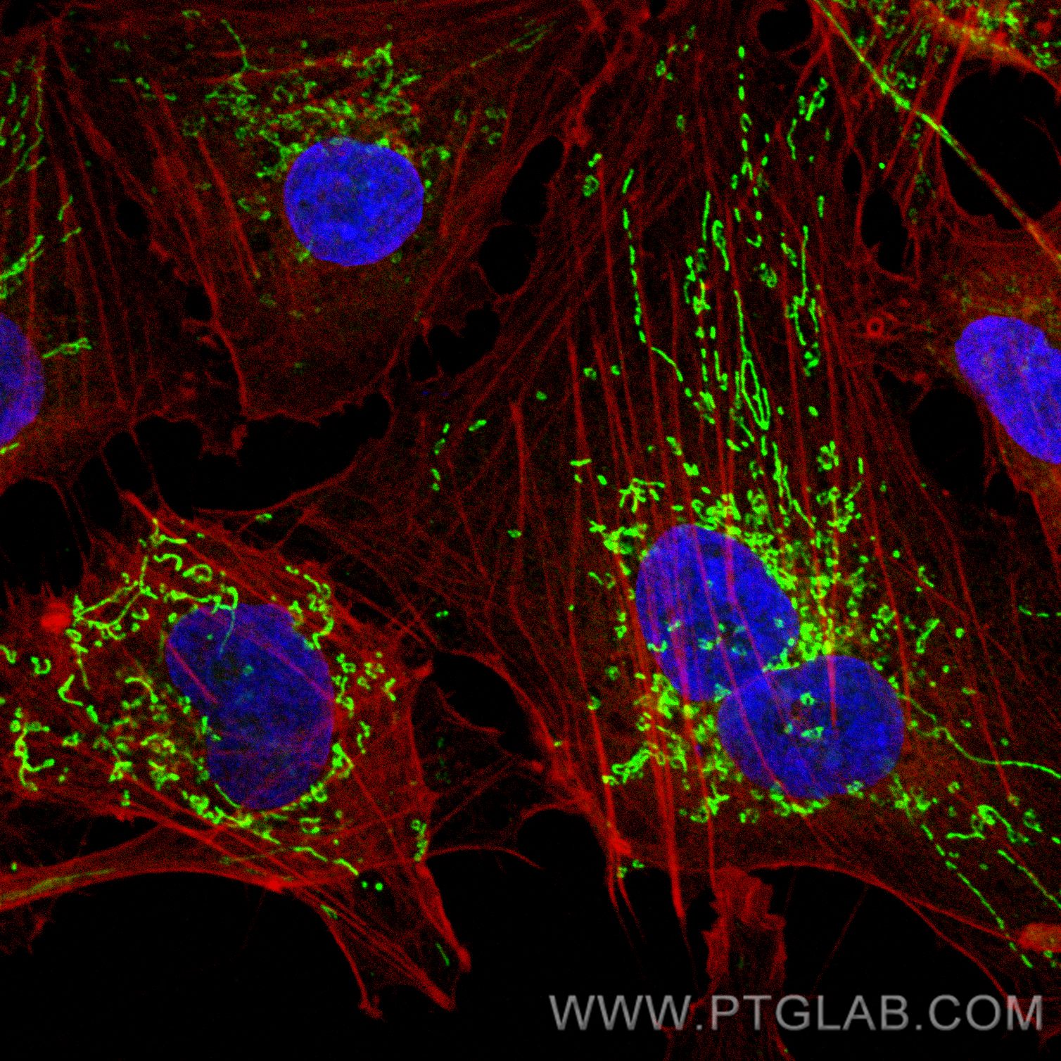 Immunofluorescence (IF) / fluorescent staining of HUVEC cells using SOD2 Polyclonal antibody (24127-1-AP)