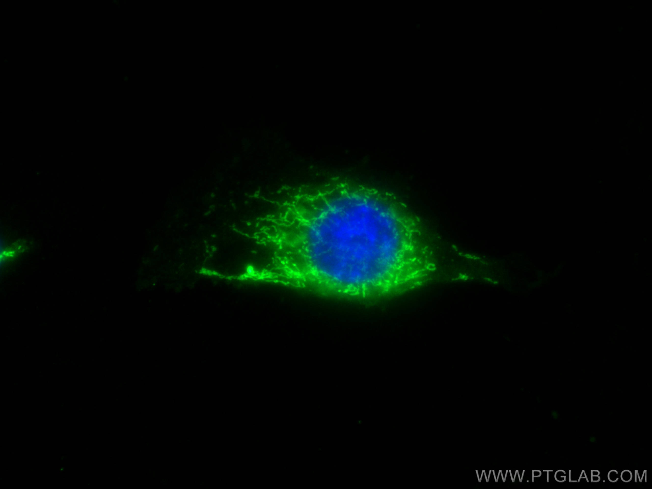 Immunofluorescence (IF) / fluorescent staining of HUVEC cells using SOD2 Polyclonal antibody (24127-1-AP)