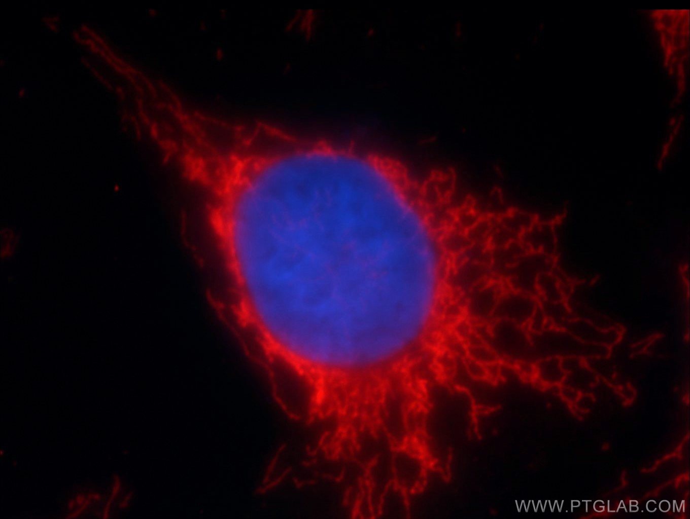 Immunofluorescence (IF) / fluorescent staining of HUVEC cells using SOD2 Polyclonal antibody (24127-1-AP)