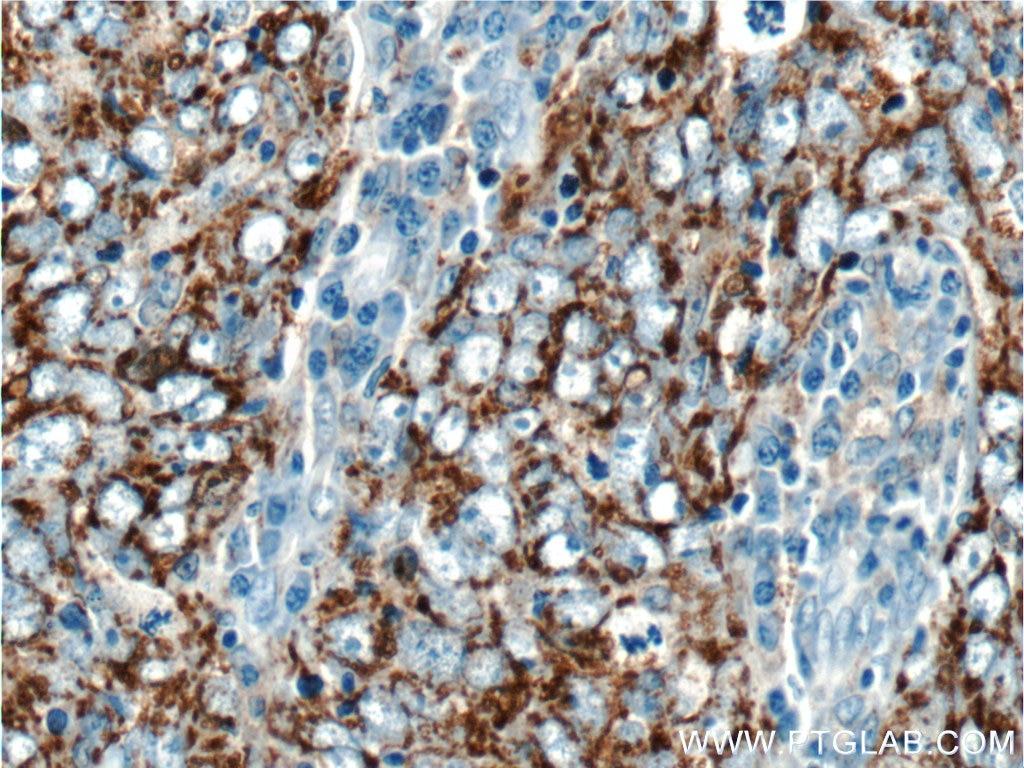 SOD2 Polyclonal antibody