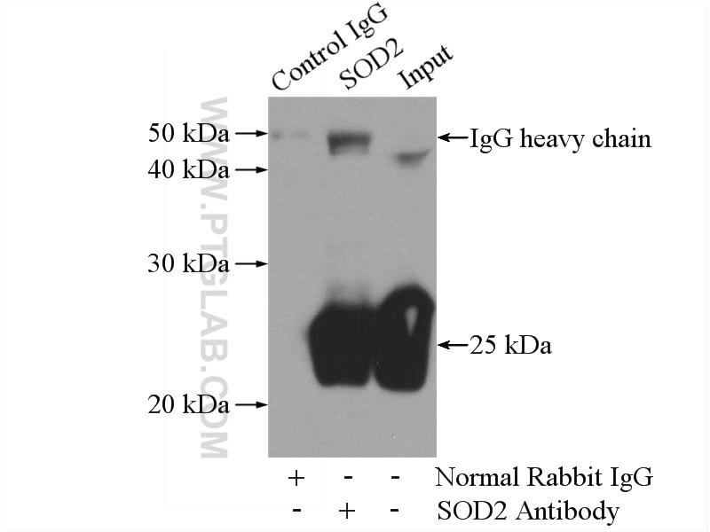 Immunoprecipitation (IP) experiment of mouse brain tissue using SOD2 Polyclonal antibody (24127-1-AP)