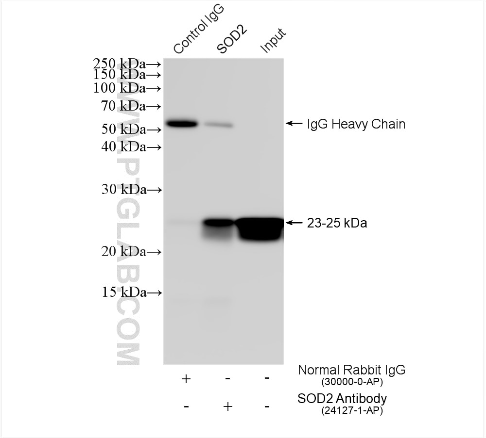 Immunoprecipitation (IP) experiment of mouse brain tissue using SOD2 Polyclonal antibody (24127-1-AP)