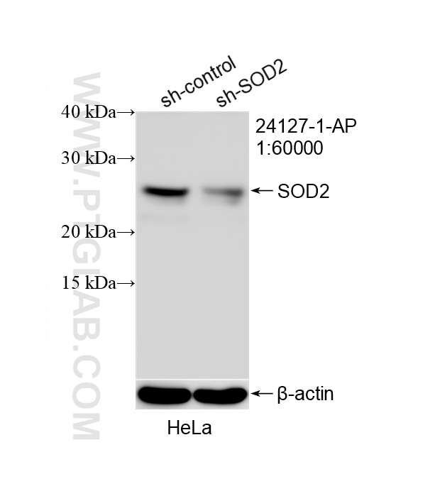 Western Blot (WB) analysis of HeLa cells using SOD2 Polyclonal antibody (24127-1-AP)